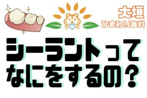 藤井シーラントってなにをするの？